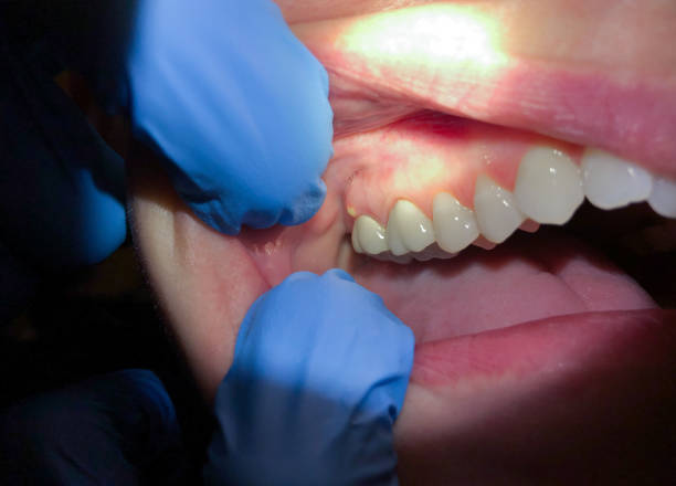 Best Pediatric Emergency Dentist in Ash Grove, MO